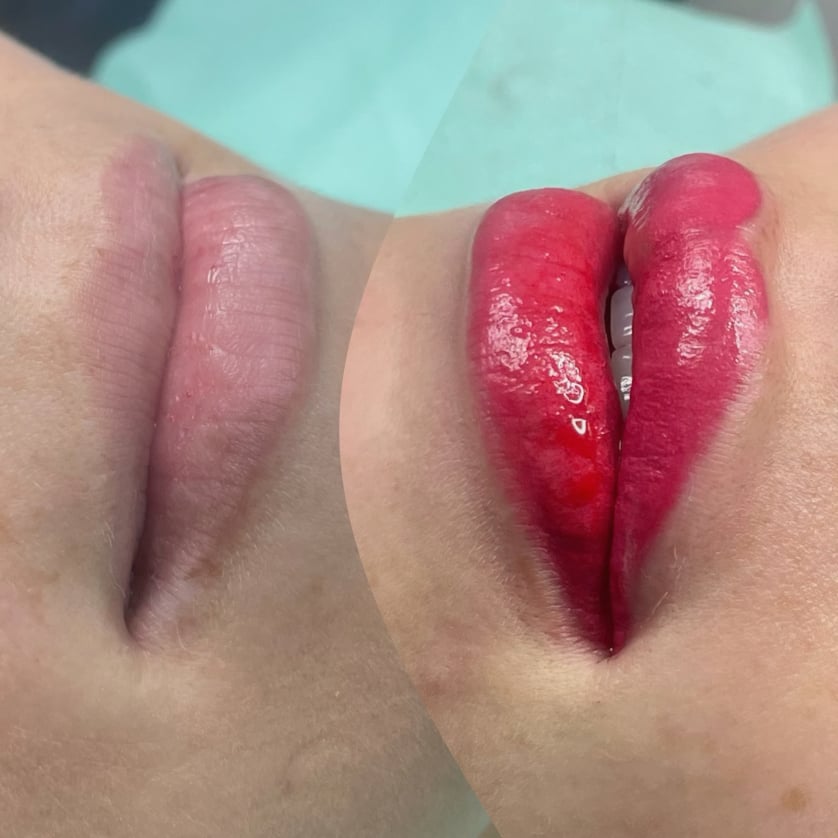 Micropigmentacion de labios